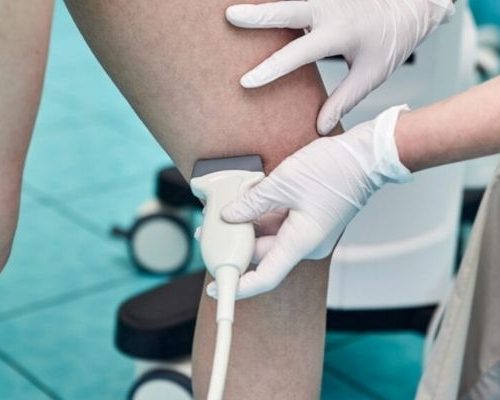 Ultrassonografia de Partes Moles com Doppler