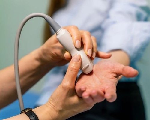 Ultrassonografia de Mão com Doppler (Unilateral)