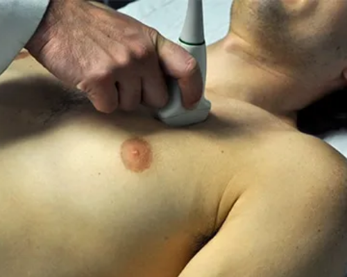 Ultrassonografia Muscular Escapular