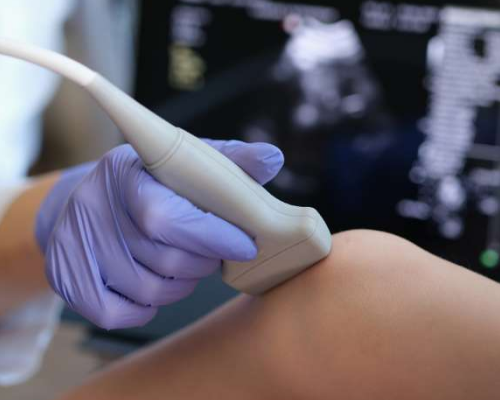 Ultrassonografia de Coxa com Doppler (Unilateral)