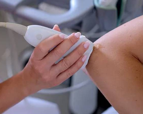 Ultrassonografia de Cotovelo com Doppler (Unilateral)