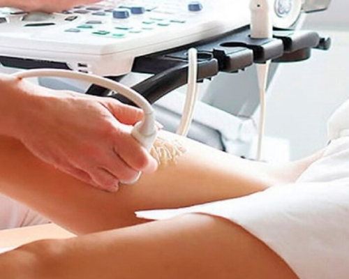 Ultrassom Doppler – Artérias Uterinas