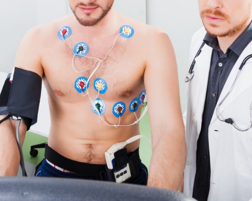 Teste Ergométrico com ECG Basal