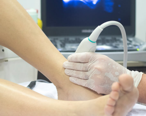 Ultrassonografia de Pé com Doppler (Unilateral)