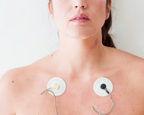 Ecocardiograma Transtorácico