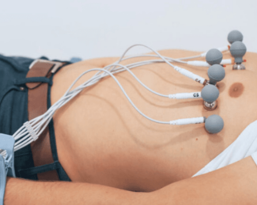 Eletrocardiograma (ECG) em Anápolis