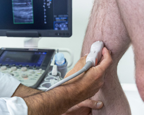 Ultrassom Doppler – Veia Cava