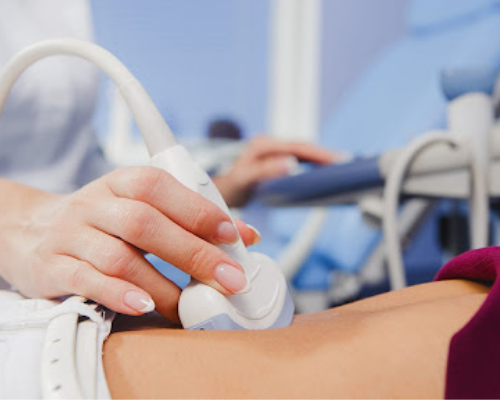 Ultrassom Doppler Venoso – Membros Superiores (Unilateral)