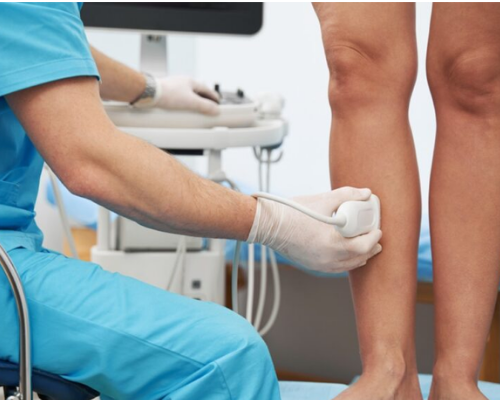 Ultrassom Doppler – Mapeamento de Varizes