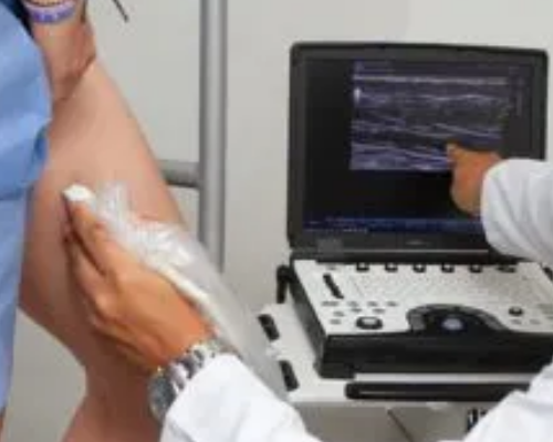 Ultrassom Doppler – Lipedema Membros Inferiores (Unilateral)