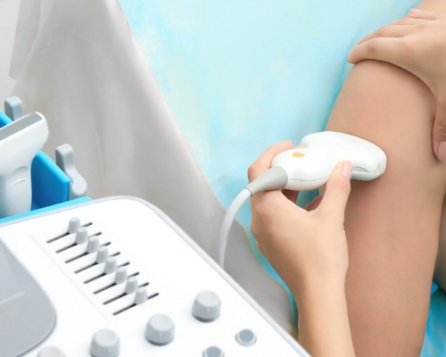 Ultrassom Doppler – Lipedema Membros Superiores (Unilateral)