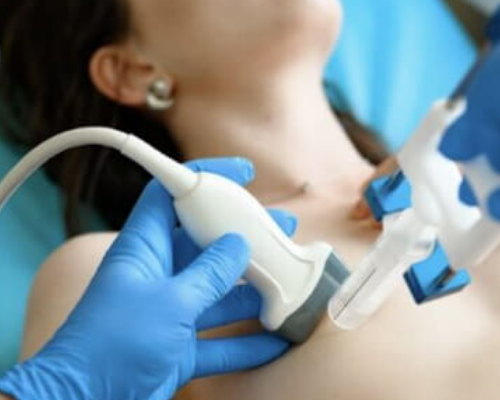 Core Biopsy (Biópsia de Fragmento)