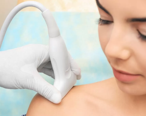 Ultrassonografia de Ombro com Doppler (Unilateral)