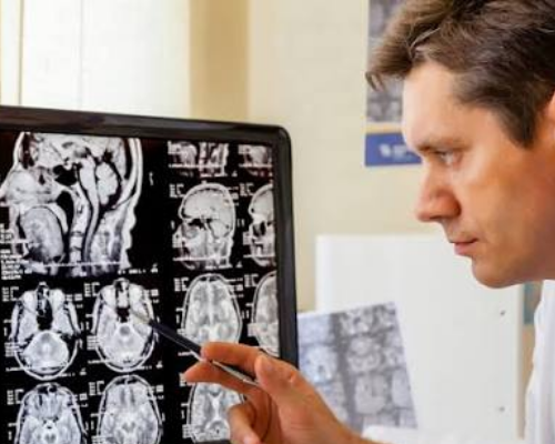 Consulta de Neurologia em anapolis