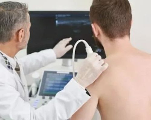 Ultrassonografia de Ombro com Doppler