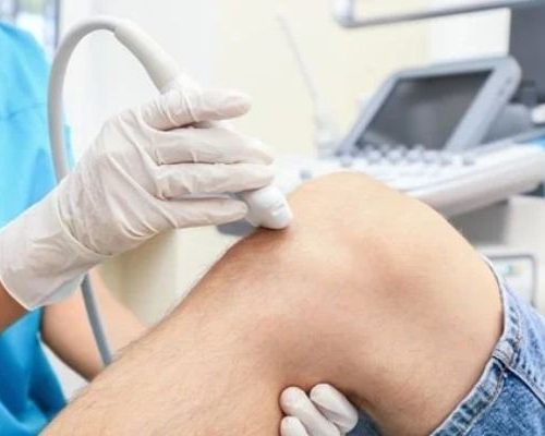 Ultrassonografia de Joelho com Doppler (Unilateral)