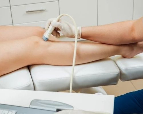 Ultrassonografia de Coxa com Doppler (Unilateral)