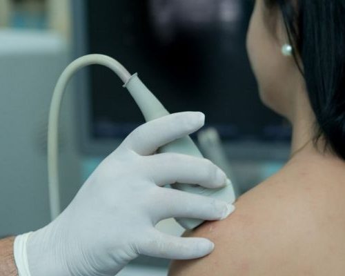 Ultrassonografia de Braço (Unilateral)