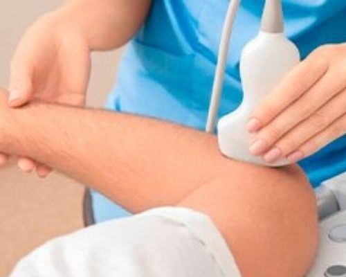 Ultrassonografia de Antebraço com Doppler (Unilateral)