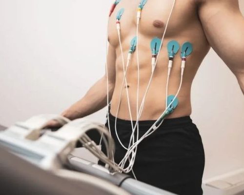Teste Ergométrico com ECG Basal