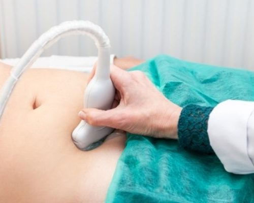 Ultrassom Doppler – Artérias Uterinas