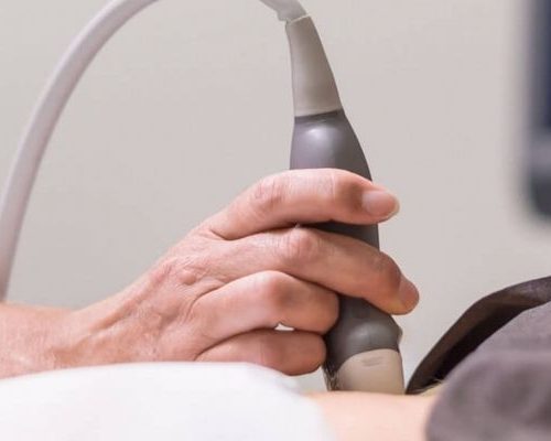 Ultrassonografia Inguinal com Doppler