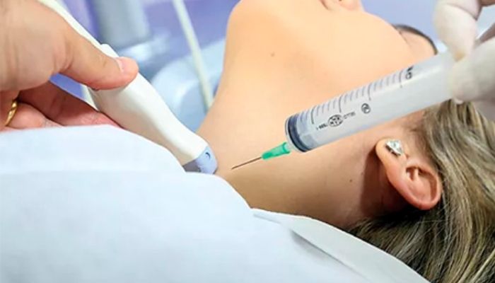 PAAF de Tireoide