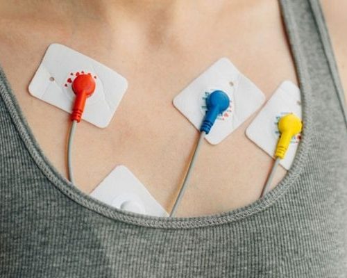 Holter 24 Horas – 2 ou Mais Canais