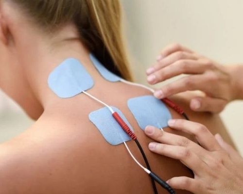 Eletroneuromiografia – Membros Superiores Bilateral