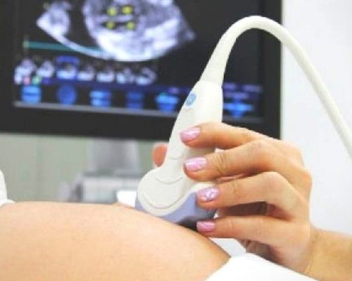 Ecocardiograma Fetal