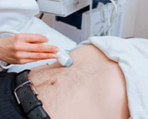 Ultrassom Doppler – Veia Cava
