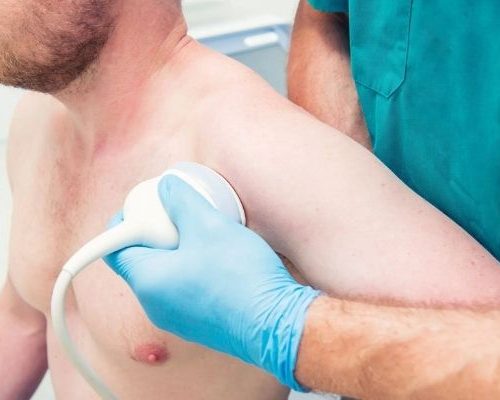 Ultrassom Doppler Venoso – Membros Superiores (Unilateral)