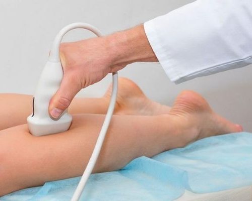 Ultrassom Doppler Venoso – Membros Inferiores (Unilateral)