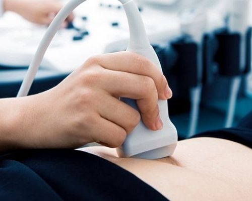 Ultrassom Doppler – Abdômen Total