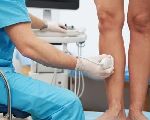 Ultrassom Doppler – Mapeamento de Varizes