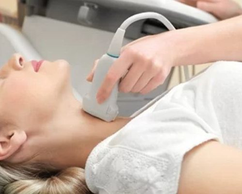 Ultrassom Doppler – Carótidas