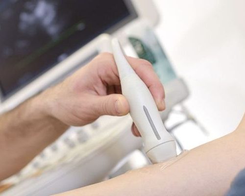 Ultrassom Doppler – Fístula Arteriovenosa para Hemodiálise