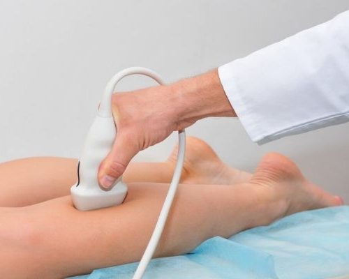 Ultrassom Doppler – Artérias dos Membros Inferiores (Unilateral)
