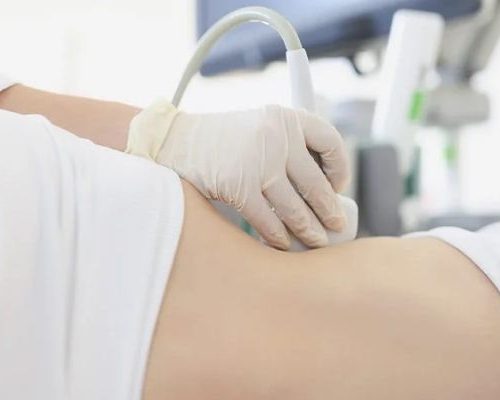 Ultrassom de quadril com doppler Anápolis
