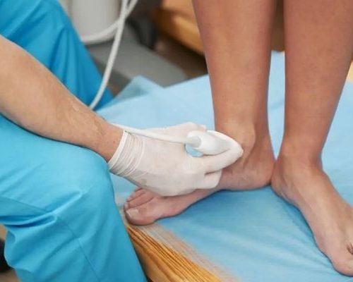 Ultrassom de tornozelo com doppler Anápolis