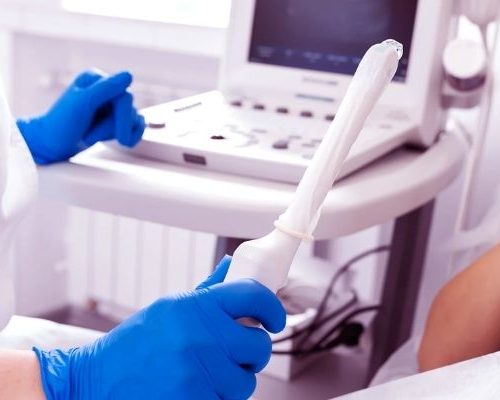 Ultrassonografia Transvaginal com Doppler