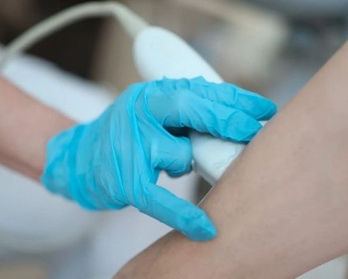 Ultrassonografia – Trombose de Veias Profundas, Risco Cirúrgico (Unilateral)