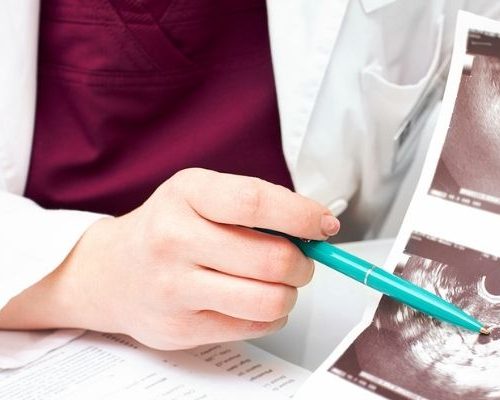 Ultrassonografia transvaginal contagem de folículos Anápolis