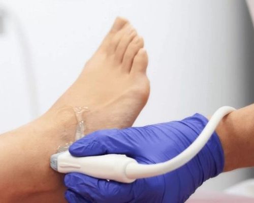 Ultrassonografia de Tornozelo (Unilateral)
